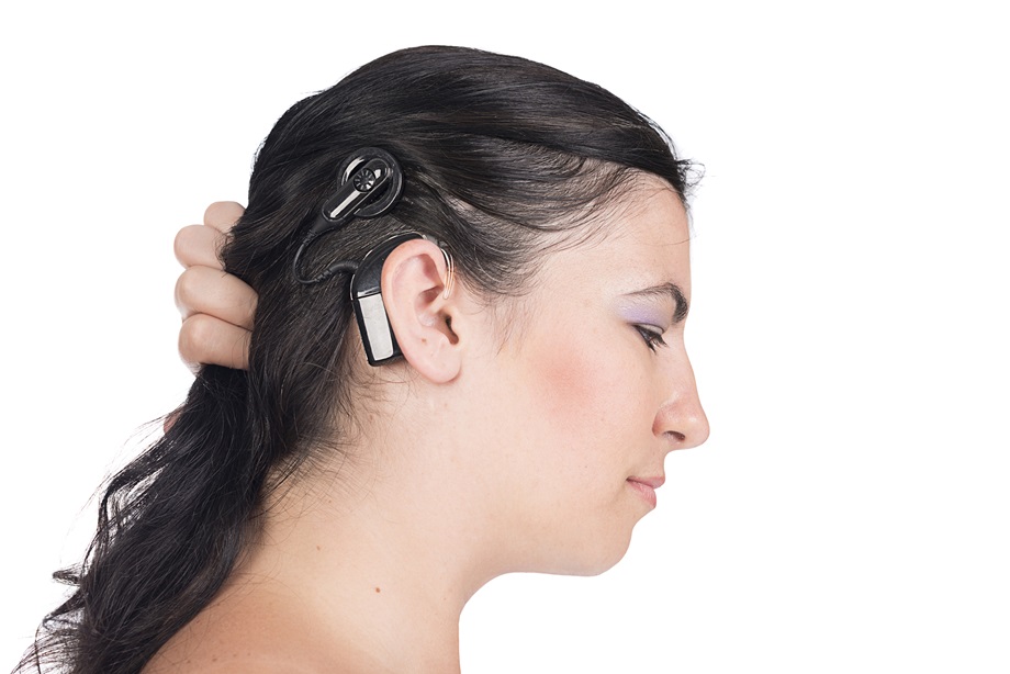 cochlear implant