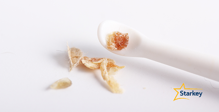earwax-cause-hearing-loss