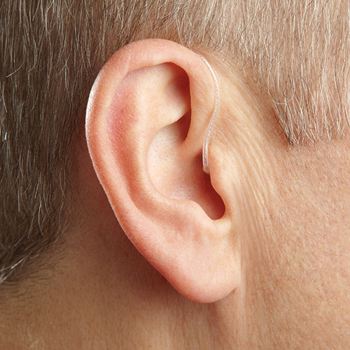 RIC hearing aid from Starkey Hearing Technologies for tinnitus